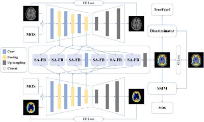 Medical image fusion quality assessment based on conditional generative adversarial network